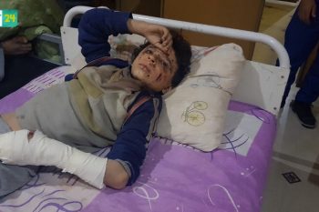 احد ضحايا انتهاكات النظام في الغوطة الشرقية