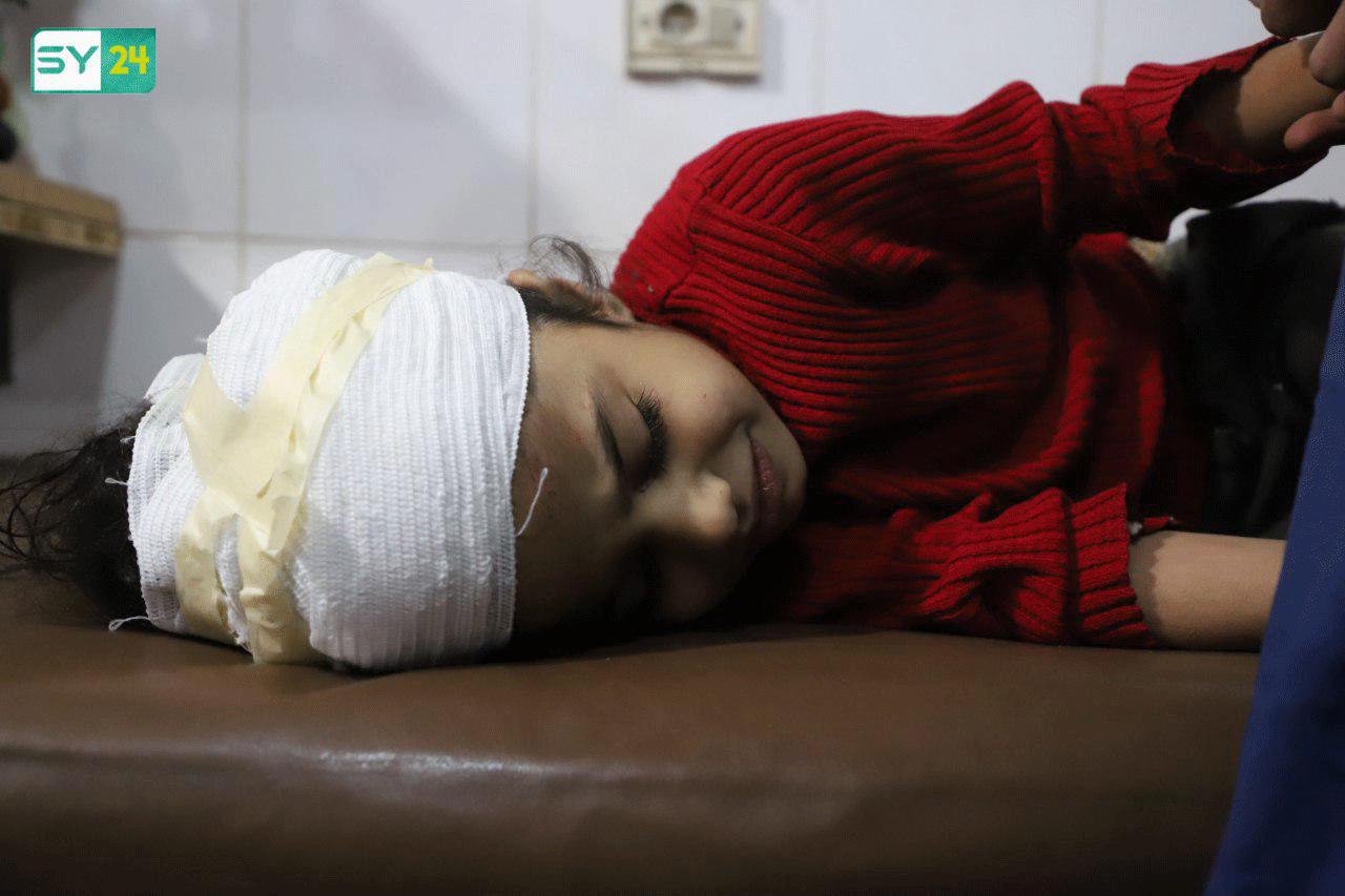 طفلة مصابة في الغوطة الشرقية