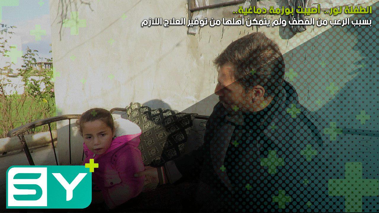 الطفلة نور..  أصيبت بوزمة دماغية بسبب الرعب من القصف ولم يتمكن أهلها من توفير العلاج اللازم