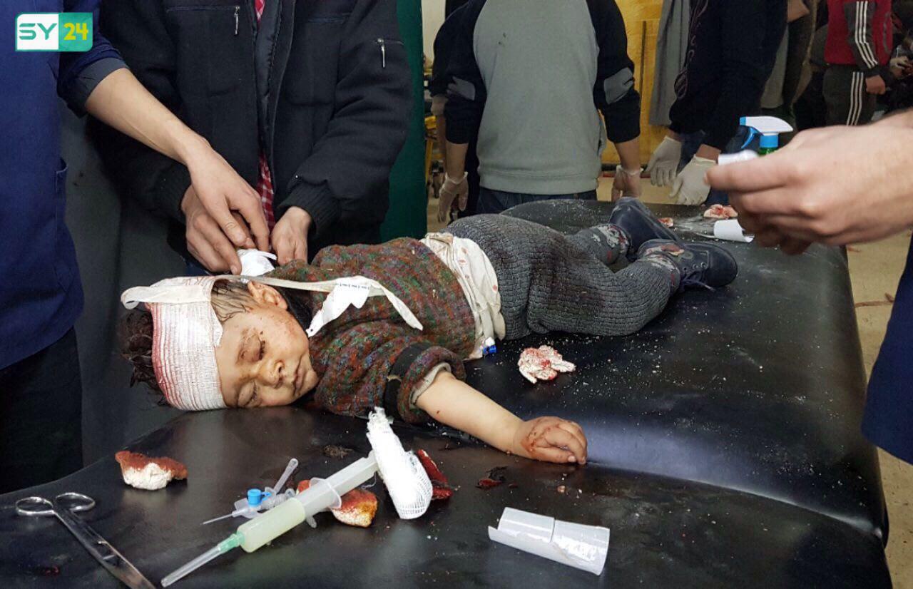 الصواريخ مزّقت أجسادهم.. صورٌ مروعة لآلام وجروح أطفال الغوطة الشرقية