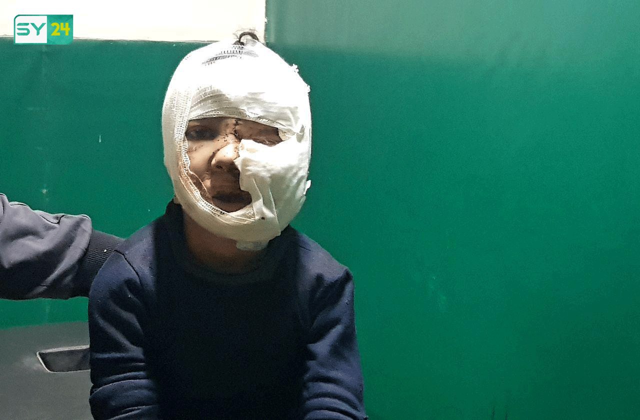 في الغوطة الشرقية.. ليسوا مصطفين كمجزرة الكيماوي.. “القنابل التقليدية” فرّقتهم