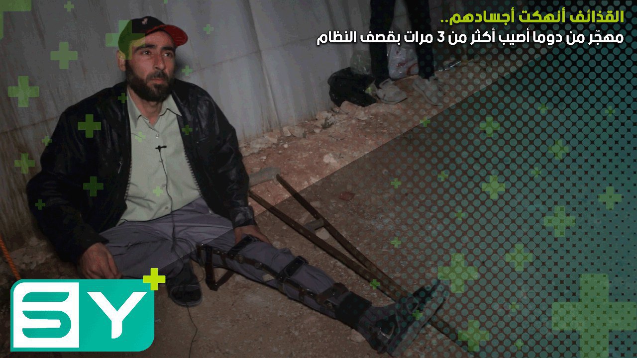 القذائف أنهكت أجسادهم.. مهجّر من دوما أصيب أكثر من 3 مرات بقصف النظام