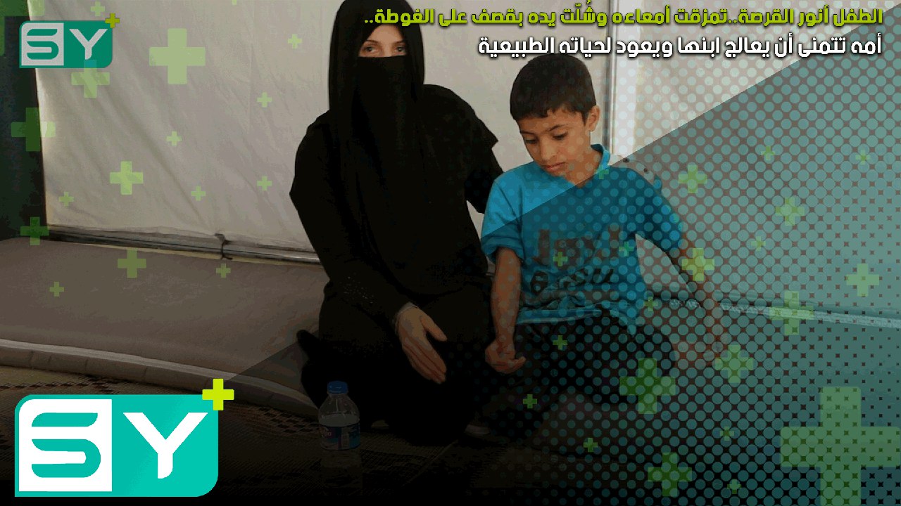 الطفل أنور القرصة.. تمزقت أمعاءه وشُلّت يده بقصف على الغوطة.. أمه تتمنى أن يعالج ابنها ويعود لحياته الطبيعية