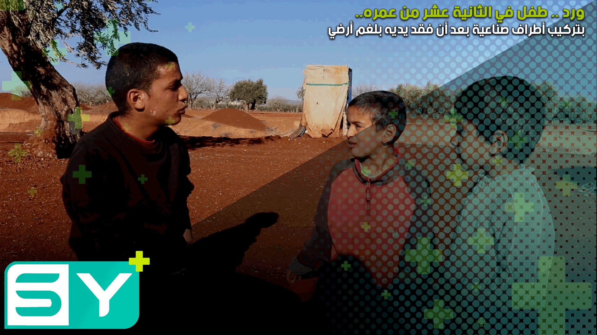 ورد .. طفل في الثانية عشر من عمره يحلم بتركيب أطراف صناعية بعد أن فقد يديه بلغم أرضي