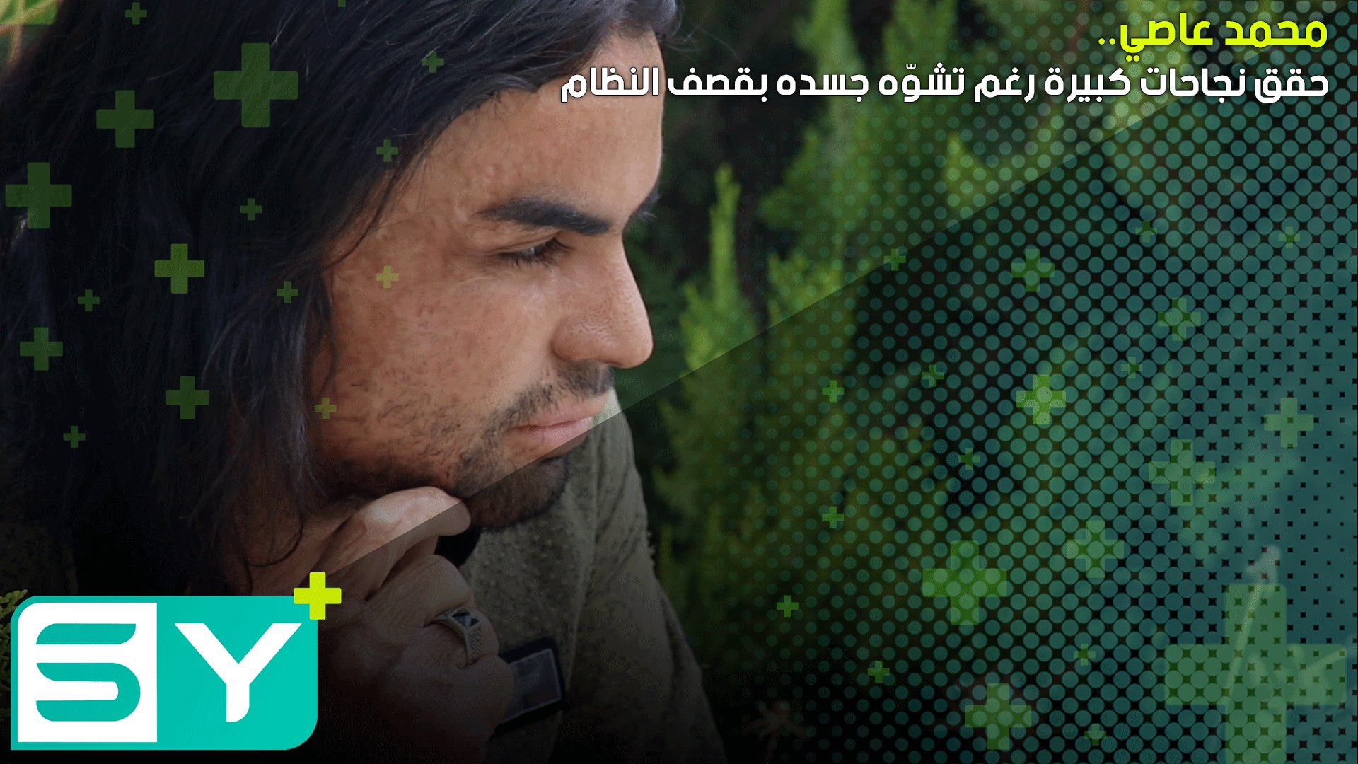 محمد عاصي.. حقق نجاحات كبيرة رغم تشوّه جسده بقصف النظام