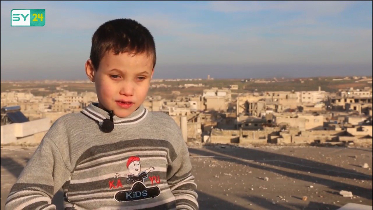 طفل فقد بصره بسبب قصف النظام.. والعمل الجراحي هو الأمل