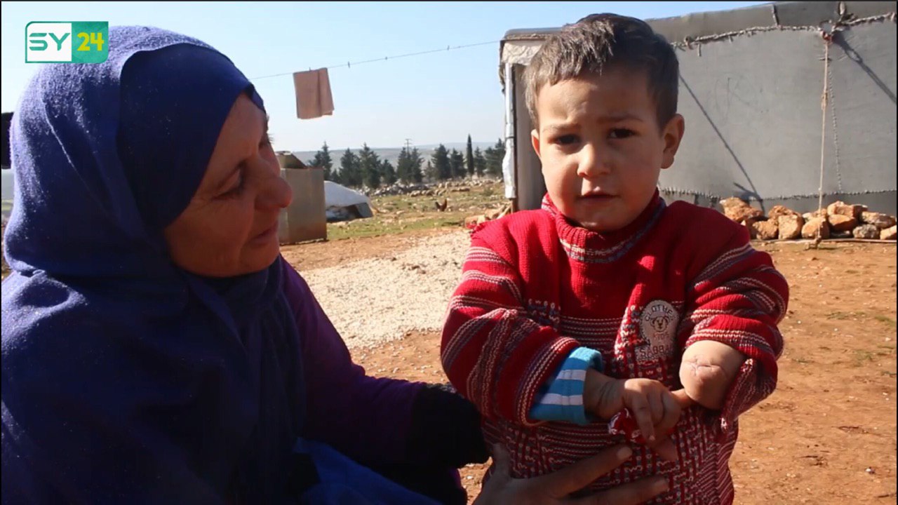 تعرف على قصة طفل فقد أهله ويده بقصف للنظام في إدلب