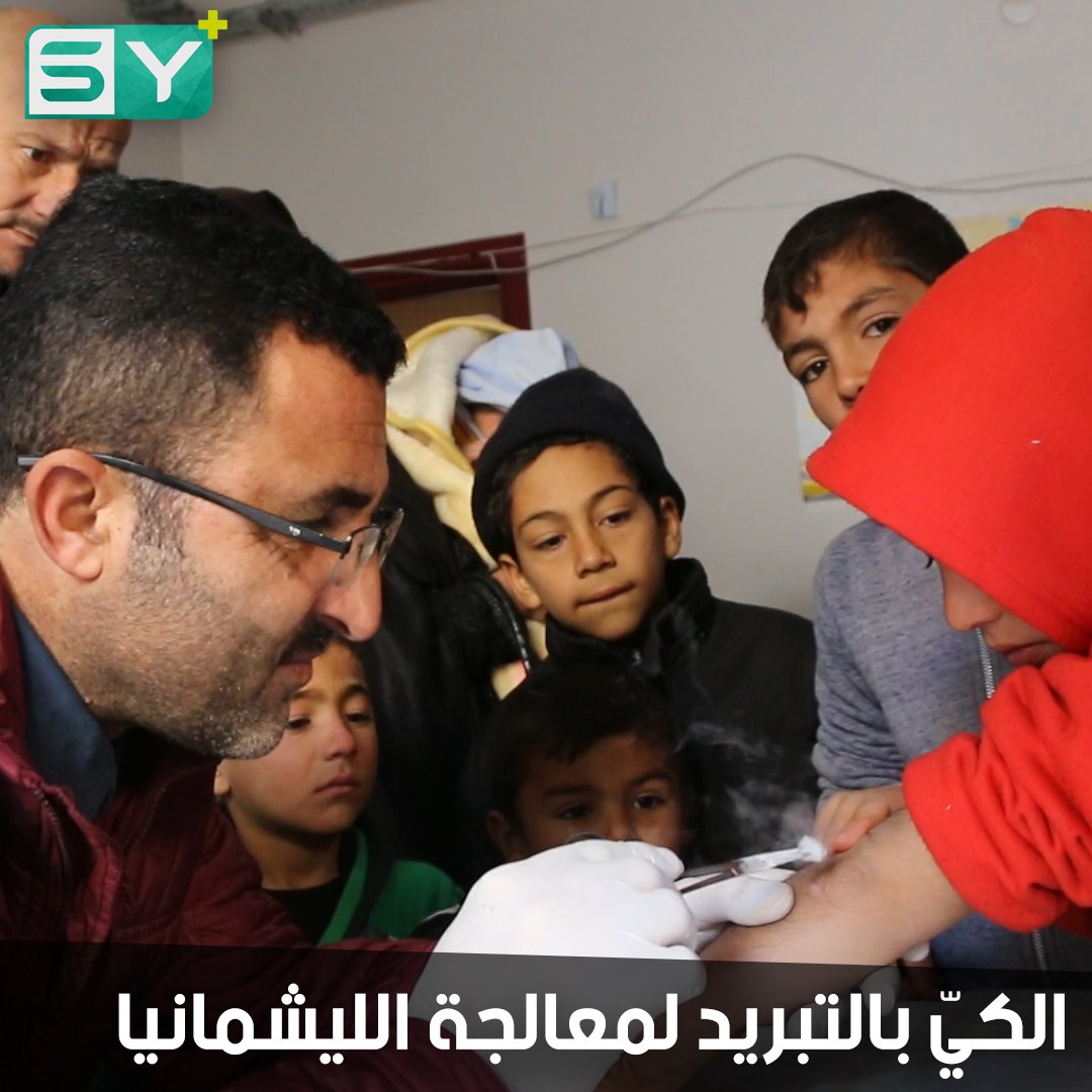 الكيّ بالتبريد لمعالجة الليشمانيا في الباب بسبب عدم توفر العلاج