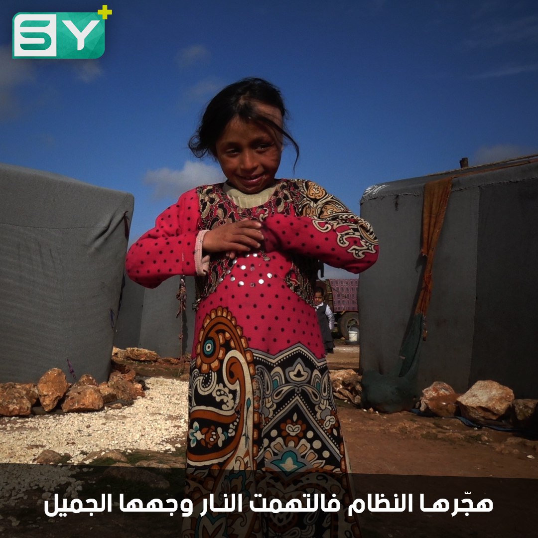 انتصار الحسن.. تشوّه وجهها بحريق يُضاف إلى مأساة النزوح