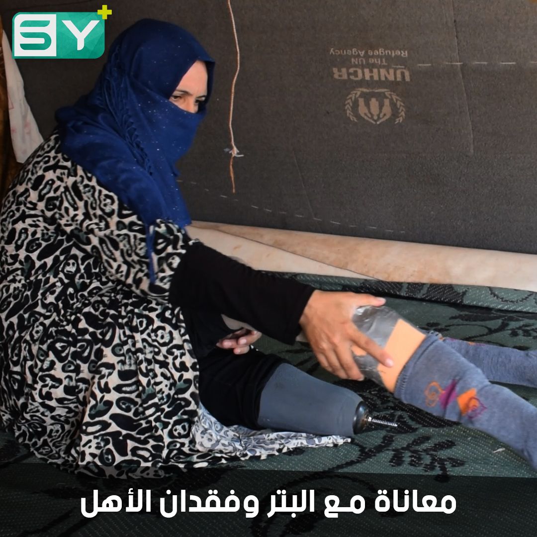 فايزة الرجب (أم صطيف).. نازحة في مخيمات أطمة فقدت أهلها وساقيها ببرميل متفجر