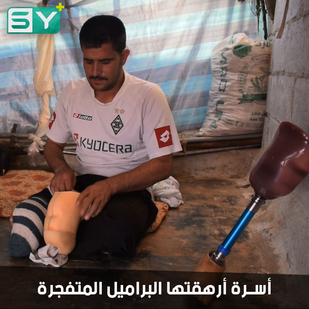 محمد حلومة نازح في مخيمات الشمال السوري.. براميل النظام بترت ساقه وقتلت ابنته