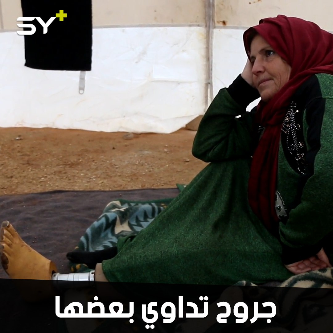 أم فؤاد.. امرأة بترت ساقها لم يبقَ لها سند في الحياة إلا ولدها المريض