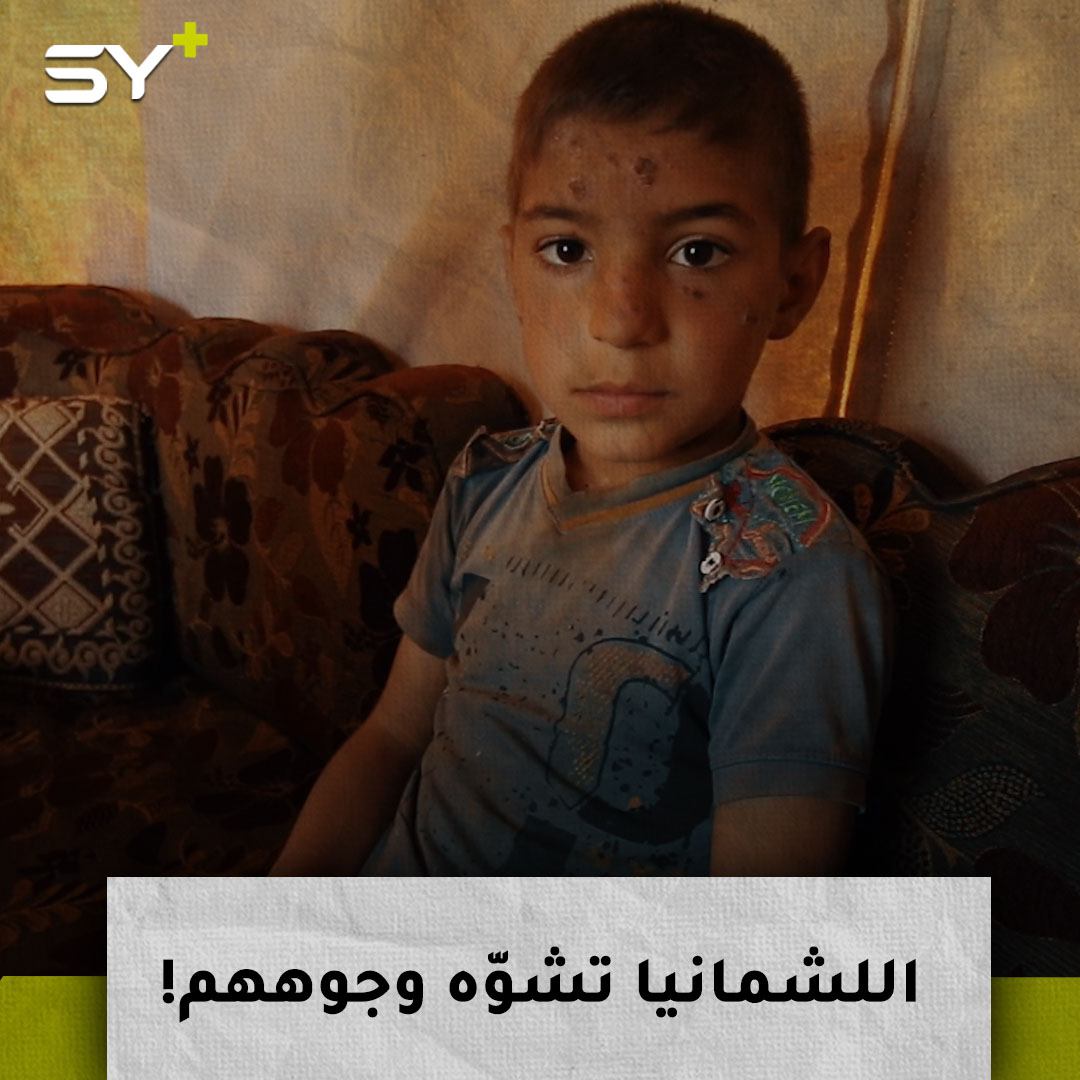 عائلة نازحة أصيبت بأكملها بـ “حبة اللشمانيا” بسبب وجود المخيم قرب مكب نفايات في ريف إدلب