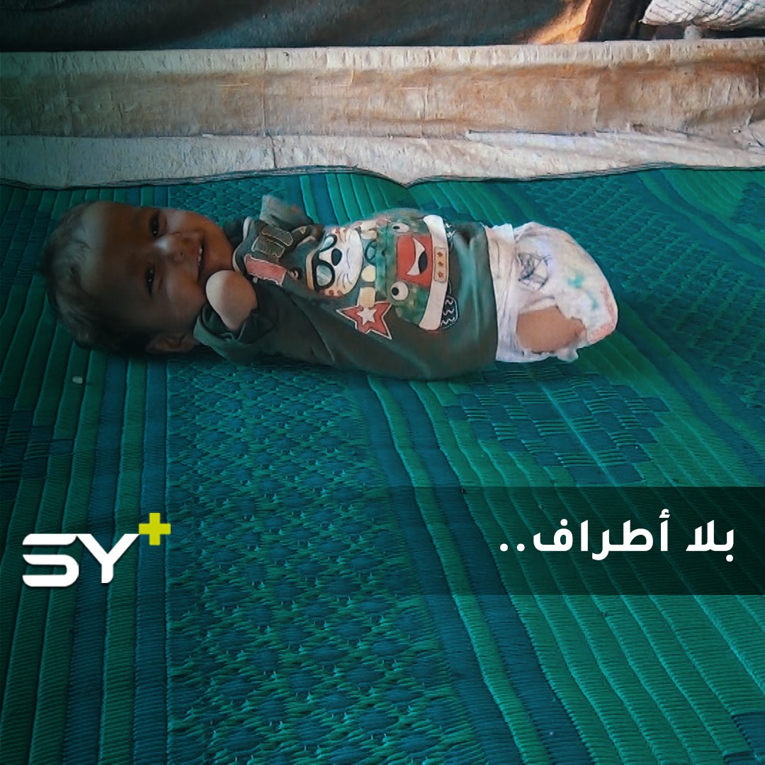 منذ الولادة خُلق محمد بلا أطراف ليبدأ حياته مع المعاناة.. تابعوا قصته