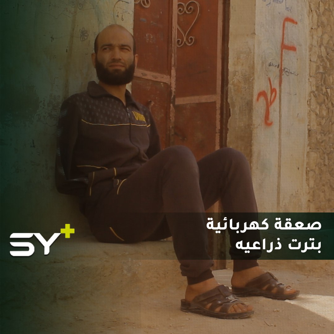 فقد كلتا ذراعيه أثناء عمله.. تابعوا قصة أحمد سيد إبراهيم من مدينة الأتارب