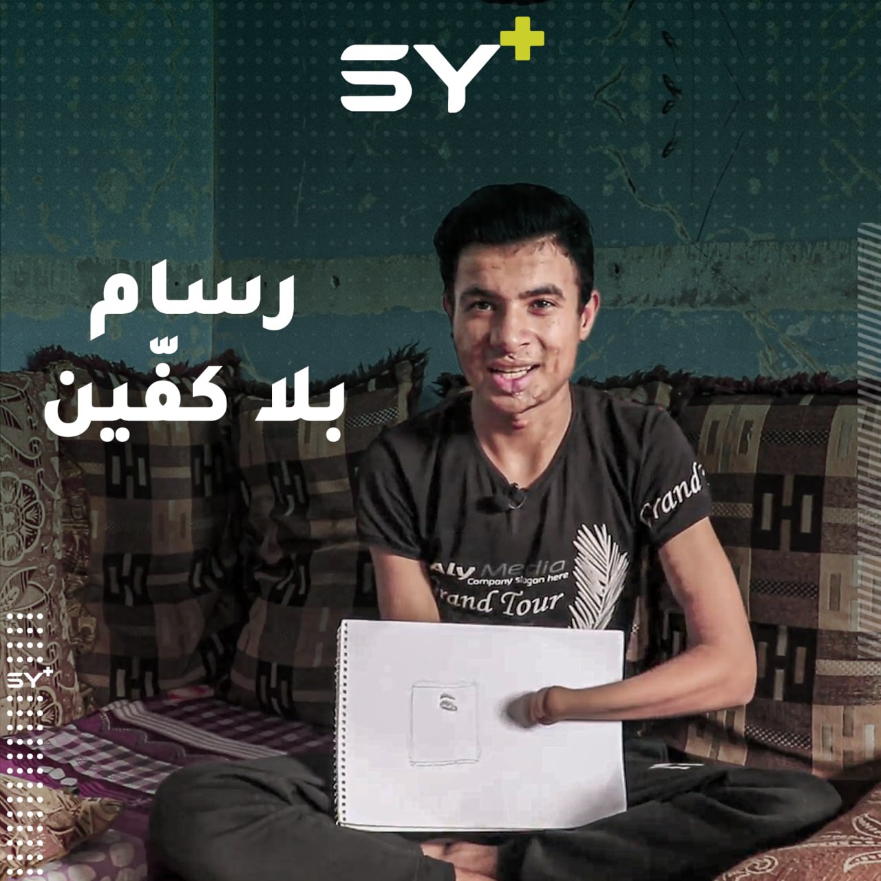 حسين شاب فقد كفّيه بانفجار لغم في الرقة.. يتابع ممارسة هوايته بالرسم