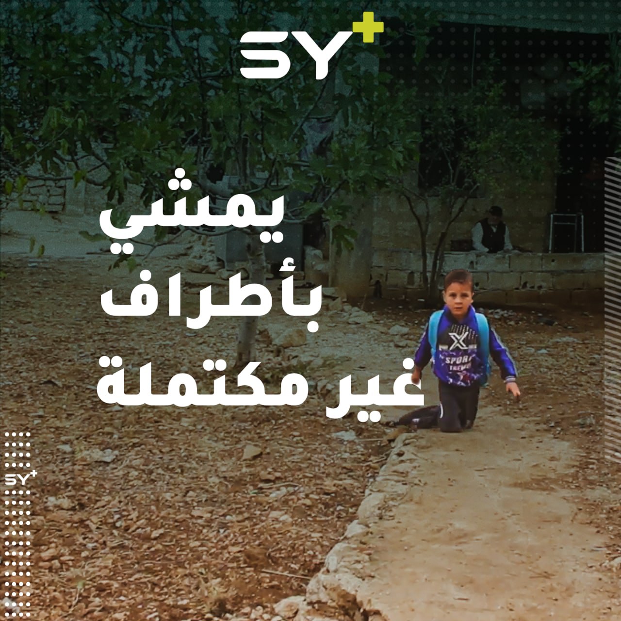 “من لما خلقت على الدنيا مالي رجلين”.. محمد طفل سوري يحاول التكيف مع حاله