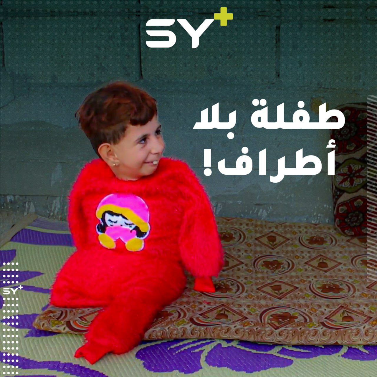 حكاية طفلة بلا أطراف.. هبة الشبيب تقاسي الحياة وسط عجز عن العلاج