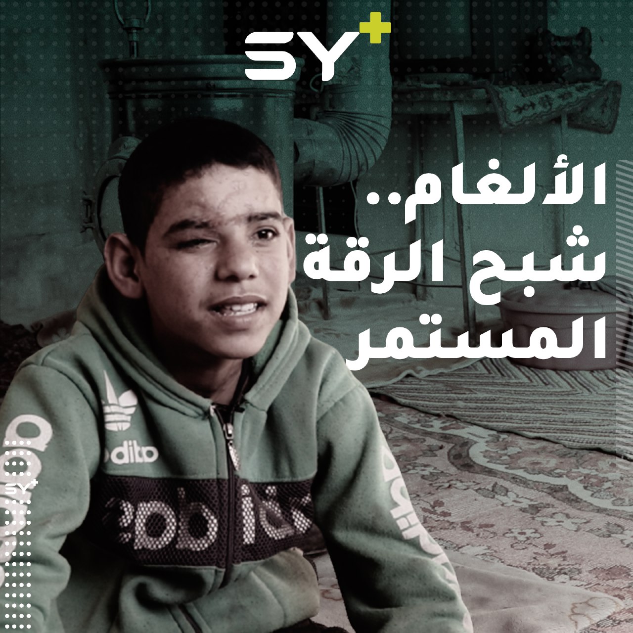 إدريس طفل فقد أجزاء من جسده بانفجار لغم في الرقة.. تابعوا قصته!