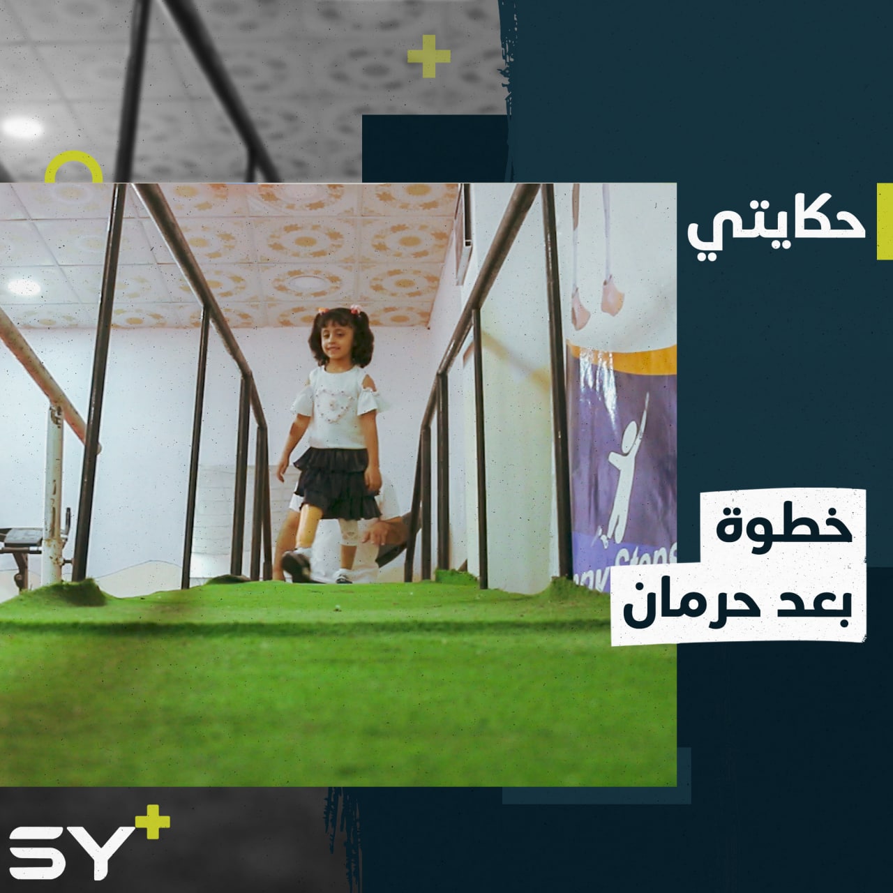 “أنا فرحانة كثير لأن بدي أمشي وألعب وأركض”.. ماريا طفلة تخطو نحو حياة جديدة بعد حصولها على طرف صناعي