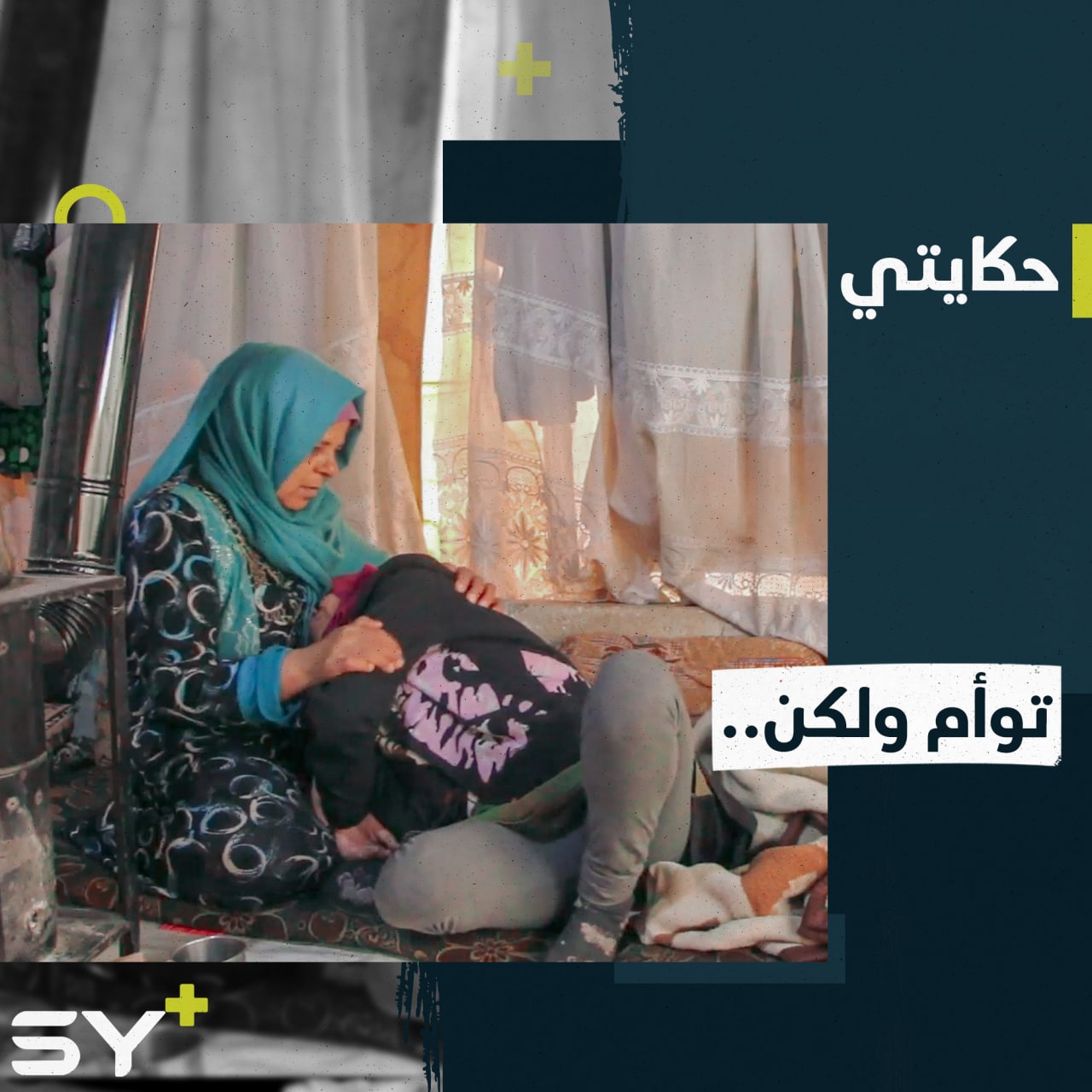 فاطمة وداليا توأم والضمور يرهق جسد إحداهما.. إليكم القصة