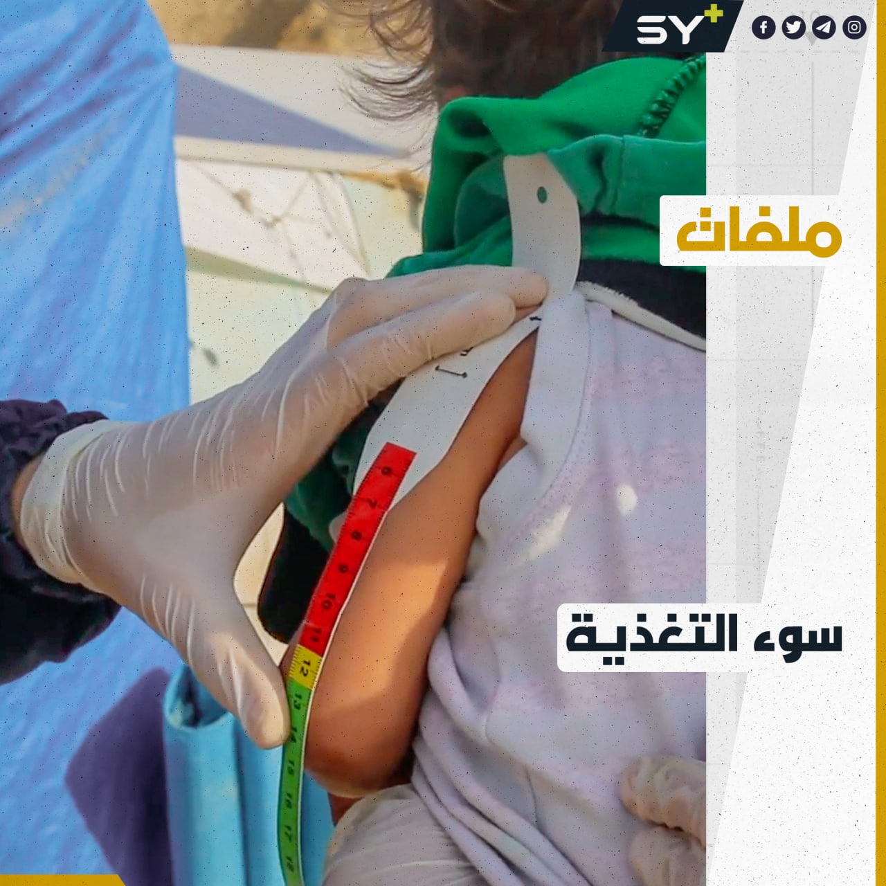 بسبب الفقر والغلاء.. آلاف الأطفال في خطر نتيجة سوء التغذية بالشمال السوري