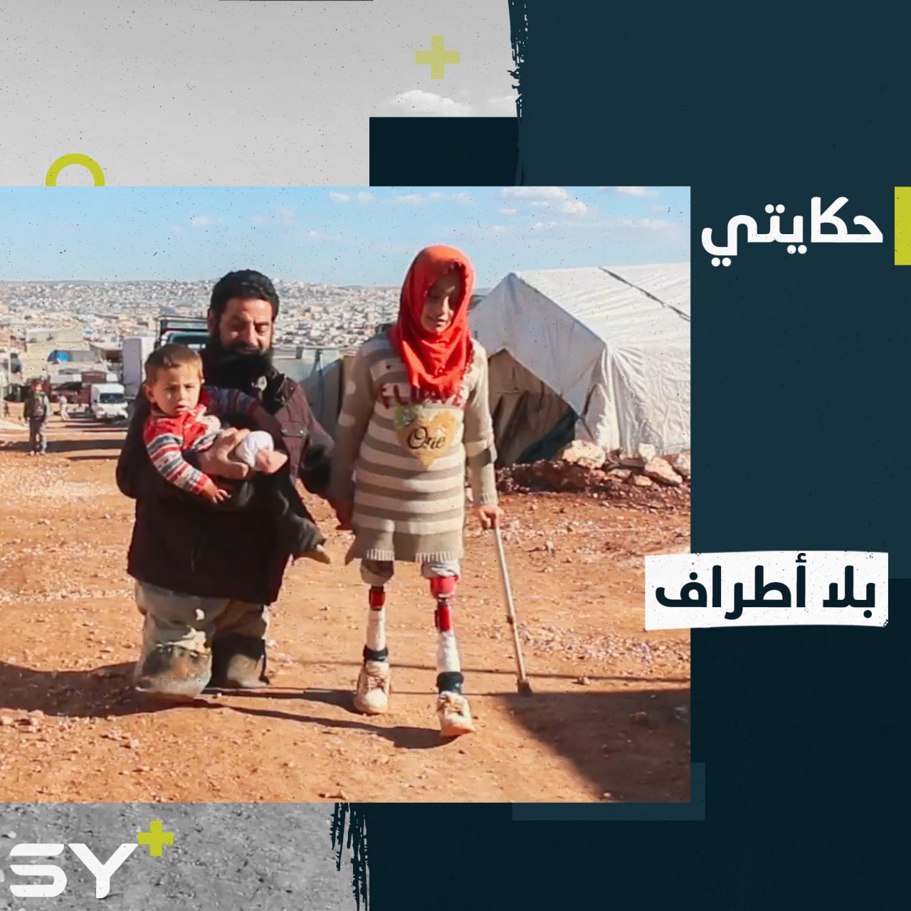 معاناة واحدة يعيشها محمد وطفليه بسبب تشوّهٍ خُلقي جعلهم بلا أطراف