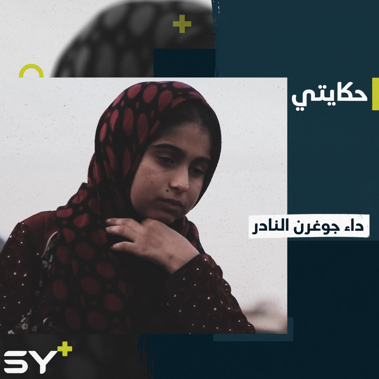 يصيب النساء أكثر بتسعة أضعاف من إصابته للرجال.. هل سمعتم عن داء جوغرن؟