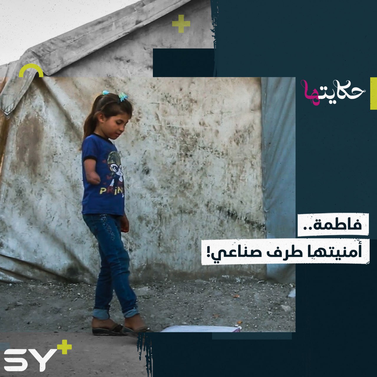 “أتمنى ألبس ثيابي لحالي”.. فاطمة طفلة فقدت يدها وتضرر نظرها بسبب قذيفة